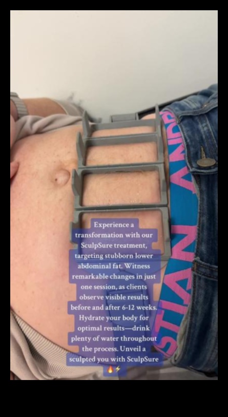 Ab Revolution: Transformative Exercises for a Sculpted Midriff