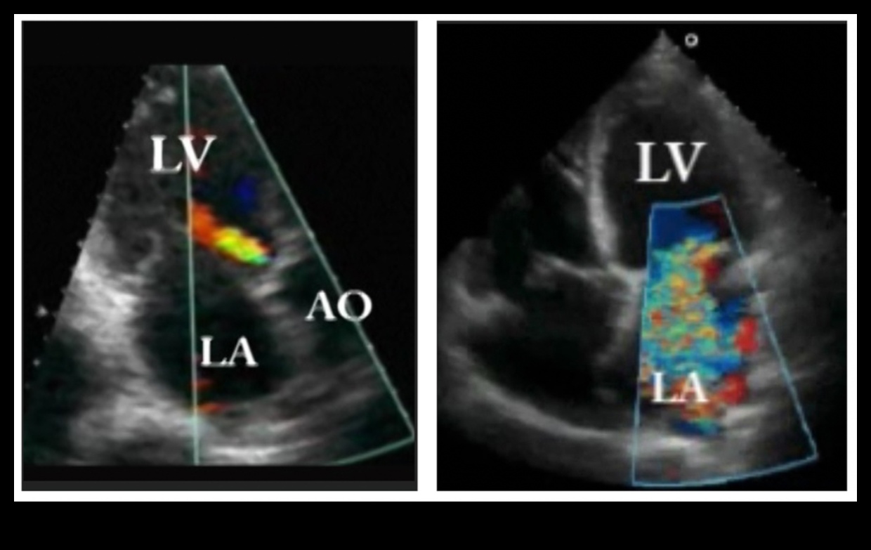 Cardiovascular Melodies: Creating Harmony in Heart Health