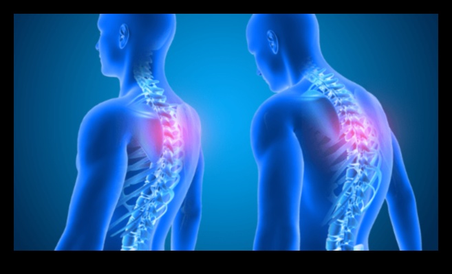 Posture Perfect: Improving Form for Safe and Effective Workouts