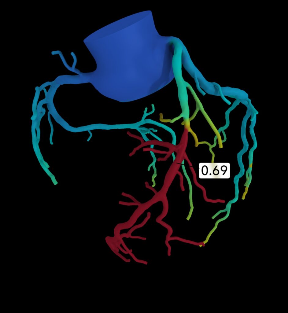 The Pulse Revolution A New Era of Cardiovascular Excellence 1